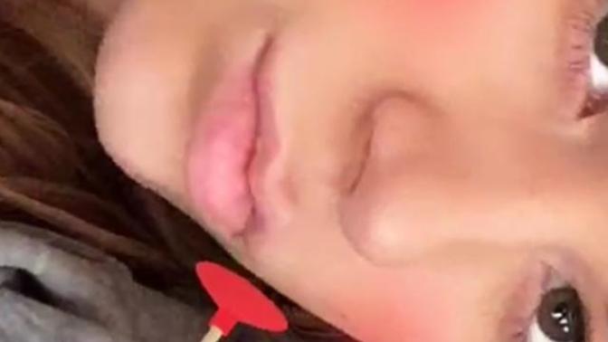 Why dose my cheeks have these two lighter parts that really show when I smile?
