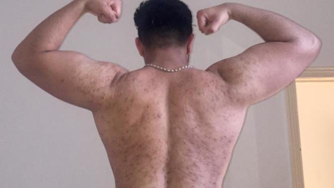 Is my body disgusting?