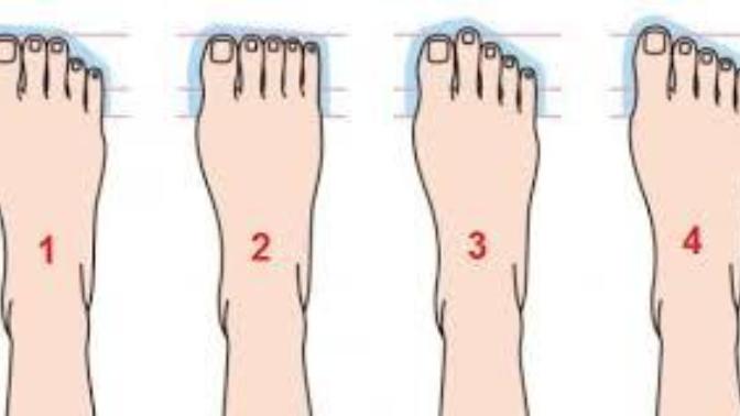 What type of foot do you have?