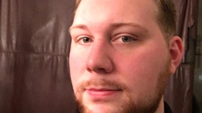 Would I be reasonably attractive if I lost weight? (Also should I shave the beard if I do?