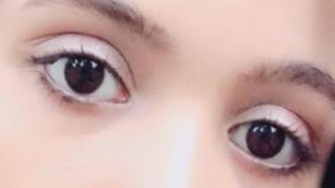 Do I have ugly frog eyes? Pics Included?