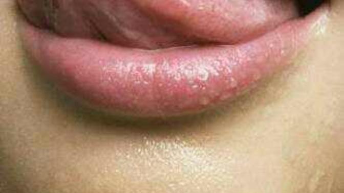 Do you lick your lips?