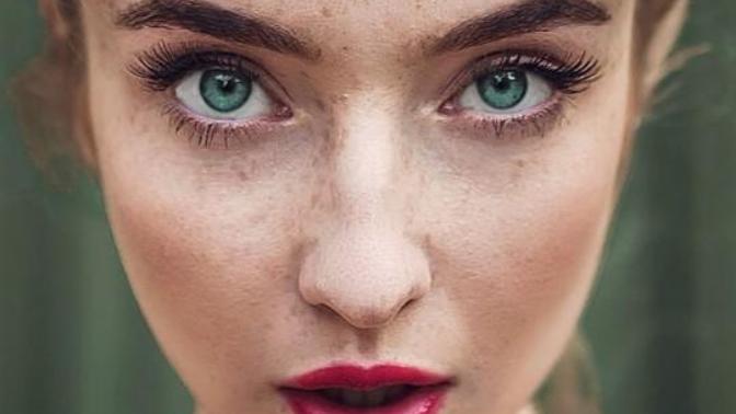 Do you find freckles attractive?