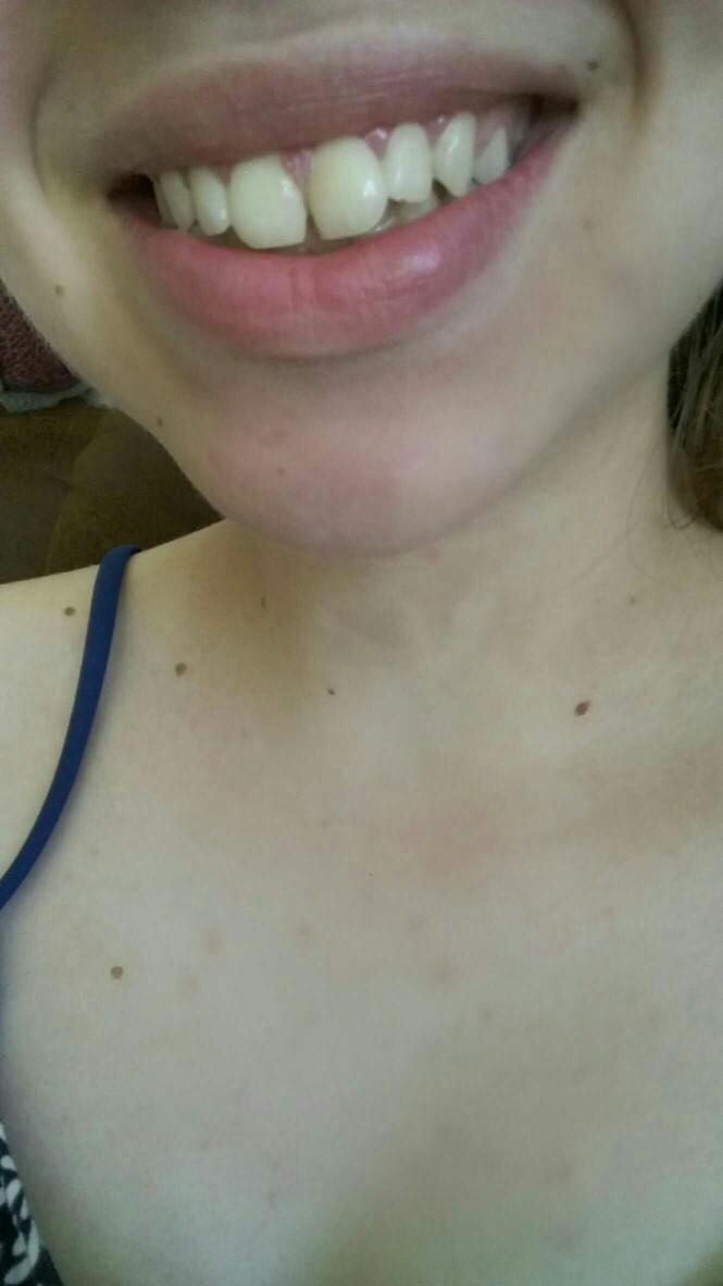 What do you think about my tooth gap?