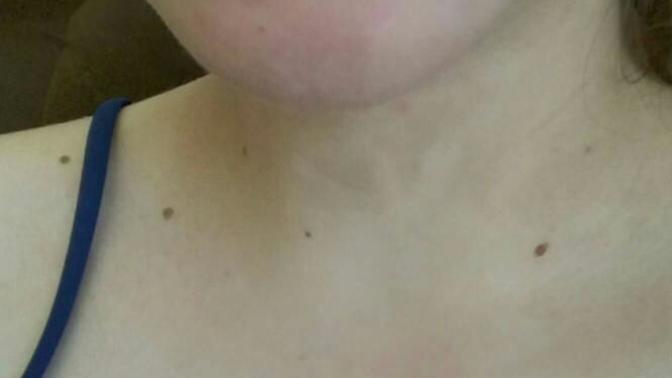 What do you think about my tooth gap?
