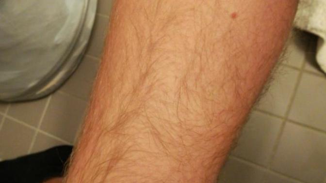 Is this too much leg hair? should I trim it?