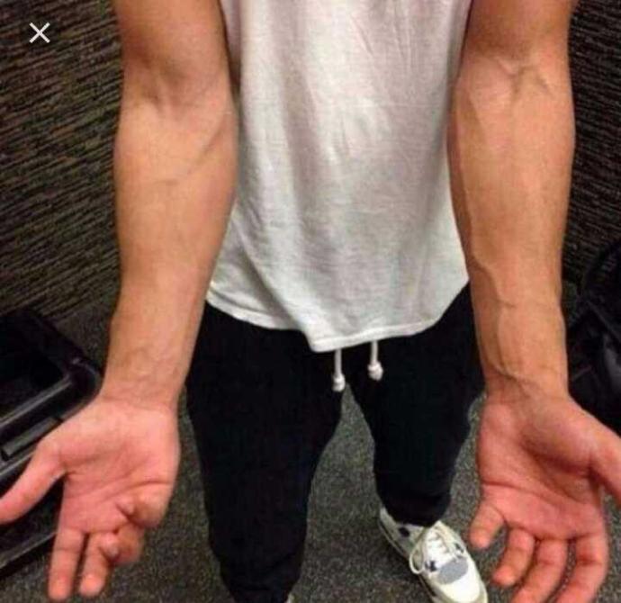 Veins on guys hands?