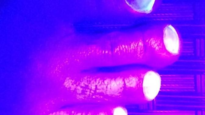 Toe nails are bright white under black light?