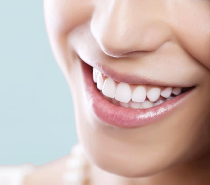 How important are white teeth to you?