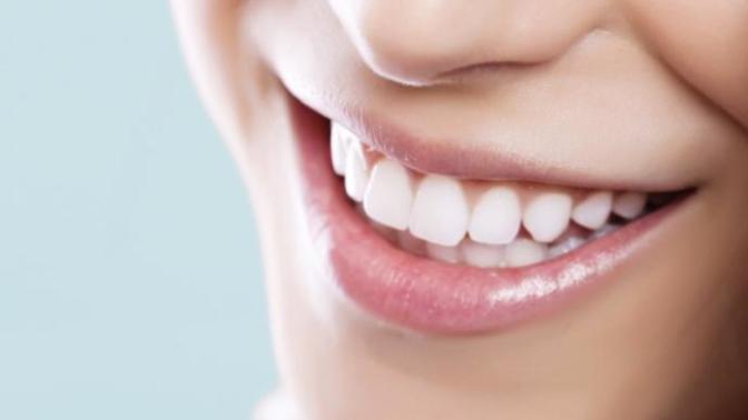 How important are white teeth to you?