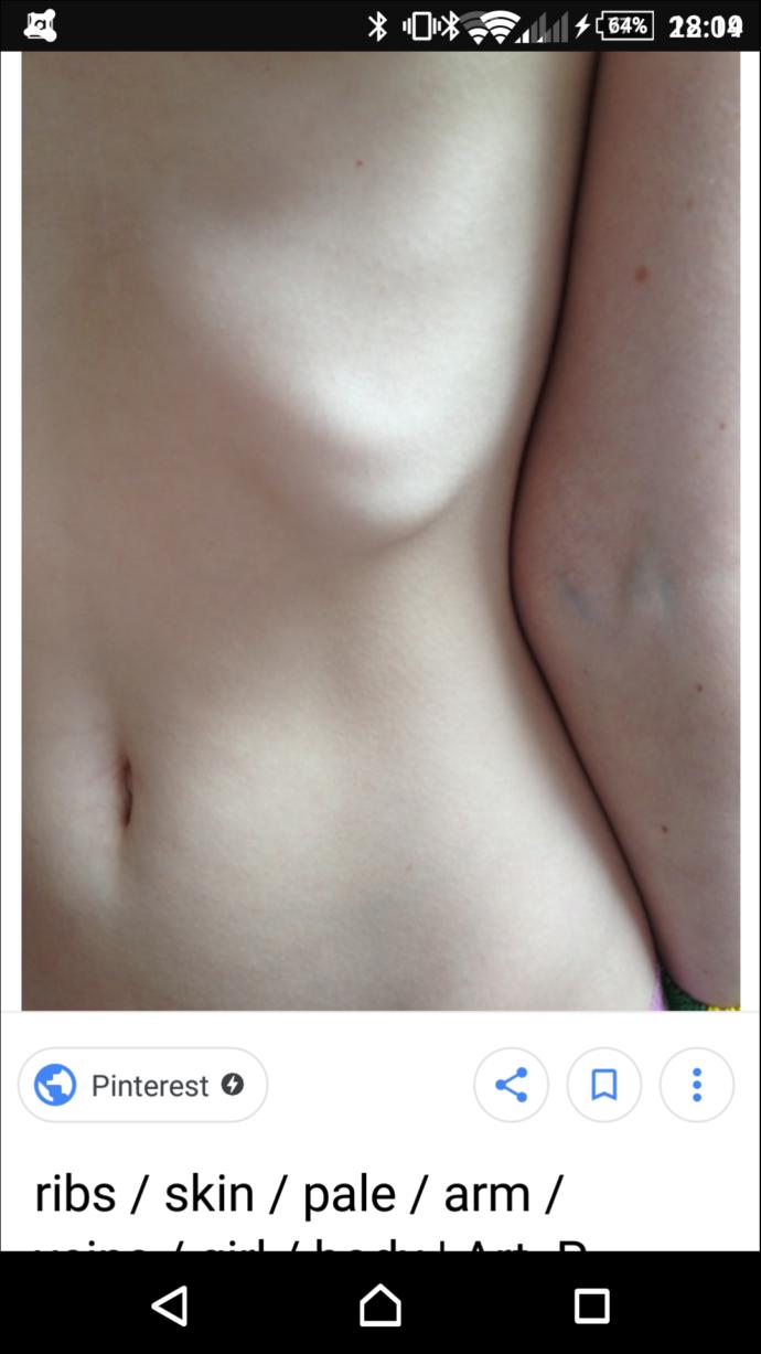 Why do some girls have vertical navel?