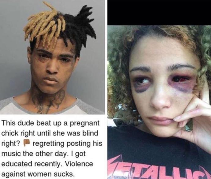How do you feel about the shooting of XXXTentacion?