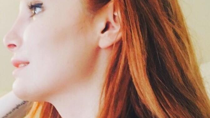 Rhinoplasty to look less ethnic?