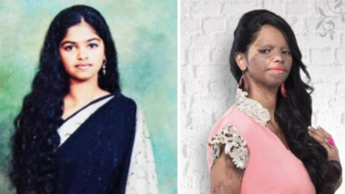 Should sale and use of acid be restricted in places where acid attack is common?