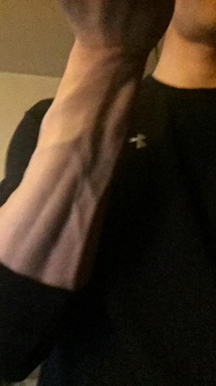 Girls , veins or not?