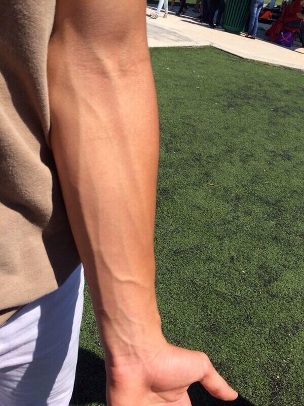 Girls , veins or not?