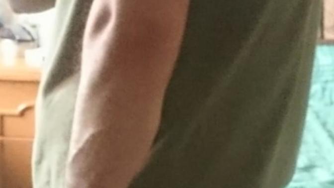 Girls , veins or not?