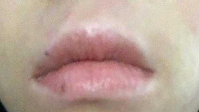 Why is the area around my lips white compared to my skin?