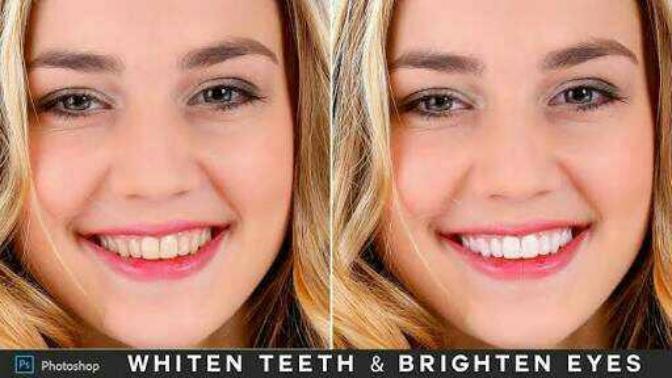 How do I get milky white teeth?