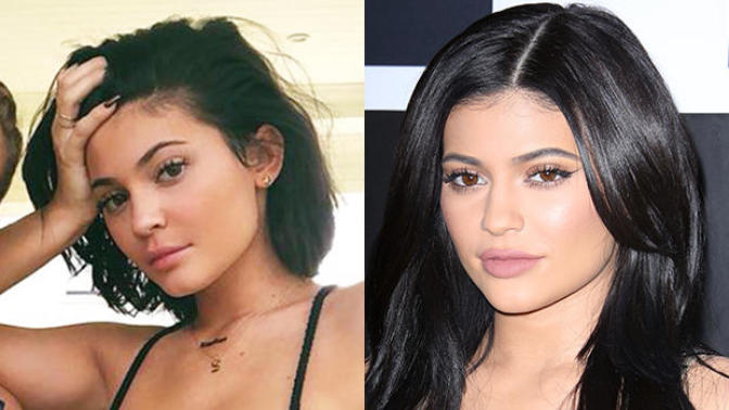 Will thin lips become a trend now that Kylie Jenner removed her fillers?