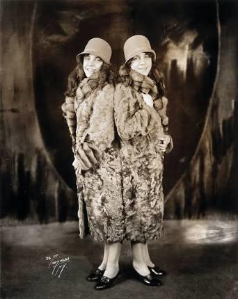 Would you date conjoined twins?