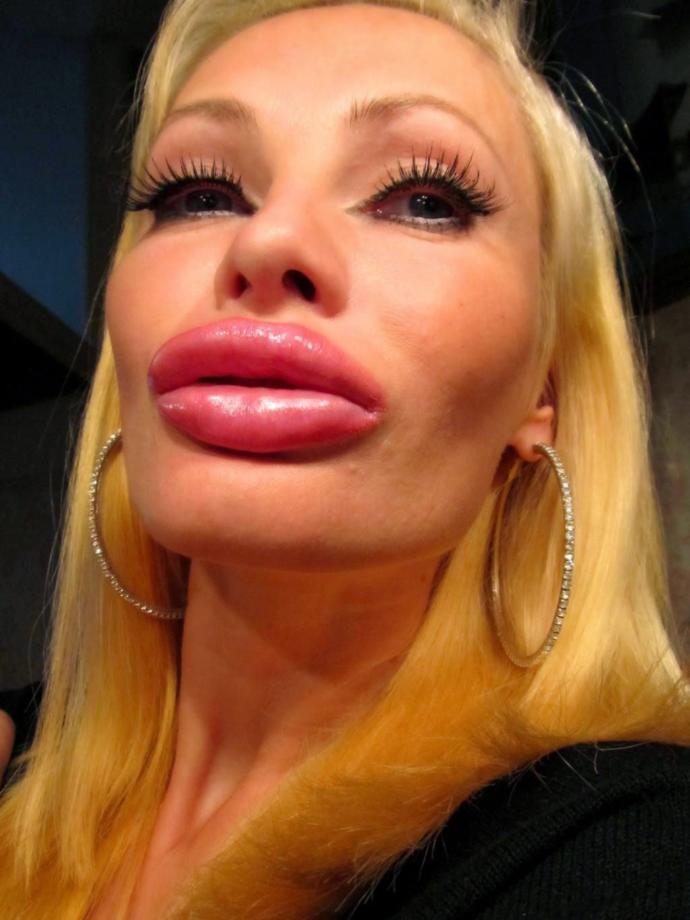 Does anyone think women who pump up their lips look good?