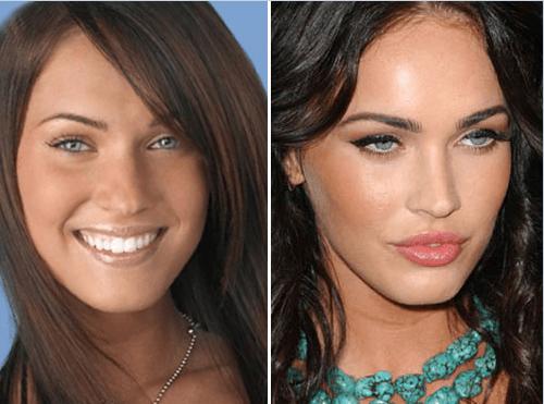 Does anyone think women who pump up their lips look good?