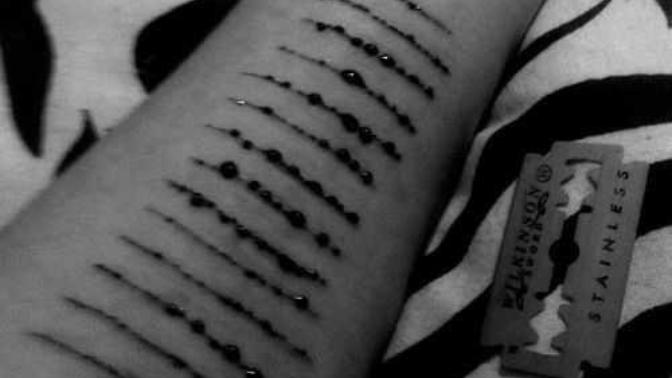 Harming yourself, slashing or cutting yourself?