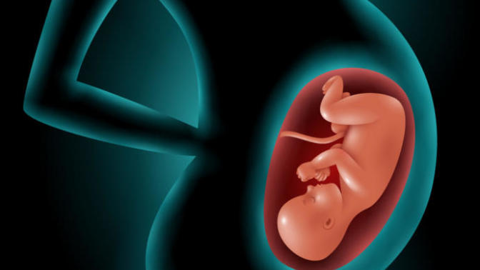 What do people who would nullify Roe v Wade with fetus rights legislation want to do to women who "violate" it's rights denying it full gestation?