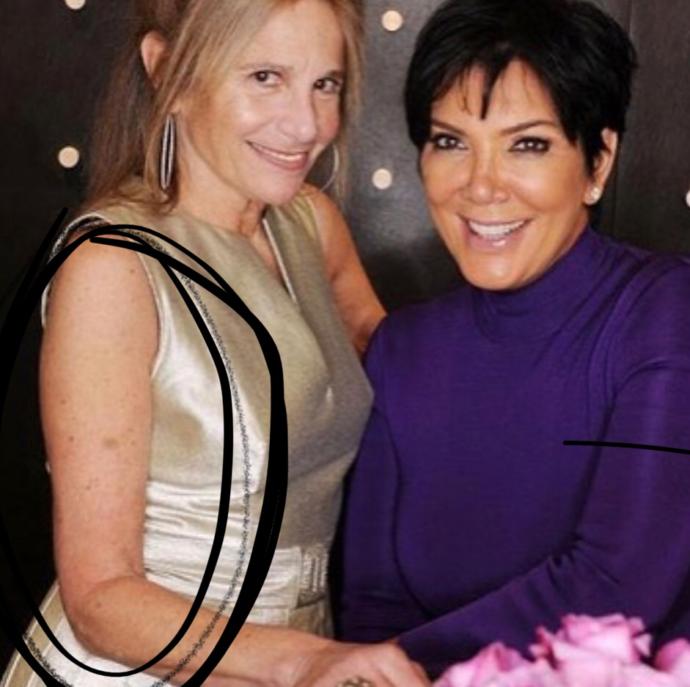 How come when white people get old their skin gets all spotty and saggy?