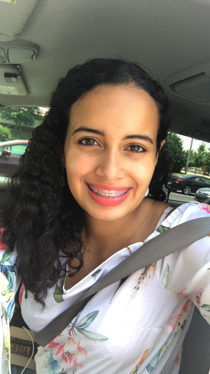 Will taking off my braces make me look really different?