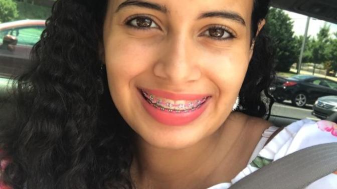 Will taking off my braces make me look really different?