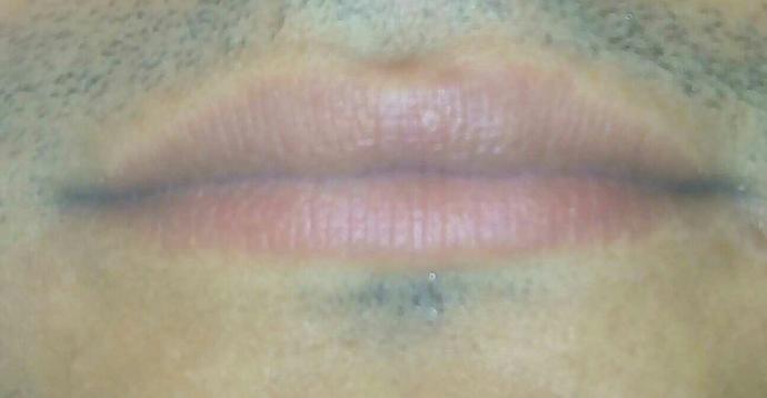 What is your lip shape?