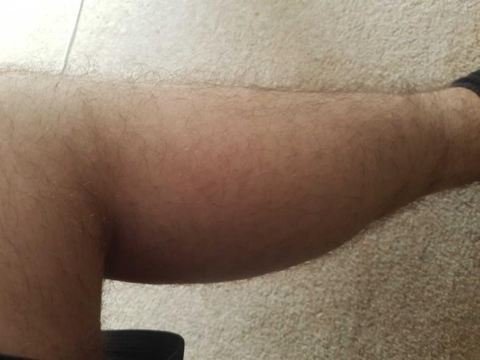 Is my leg too hairy to get tattooed?