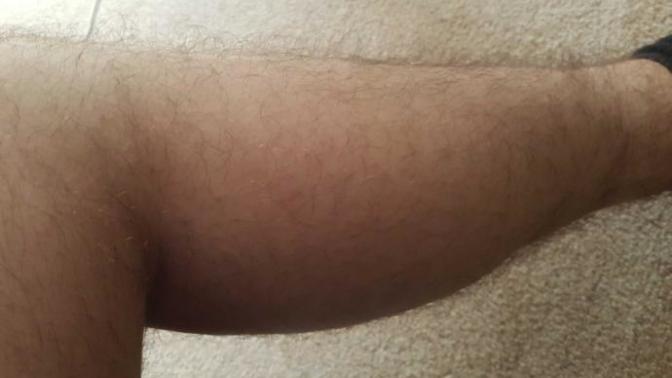 Is my leg too hairy to get tattooed?