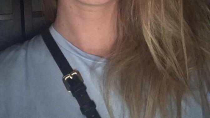 My lips are so small as you can see - Should I get my lips done?
