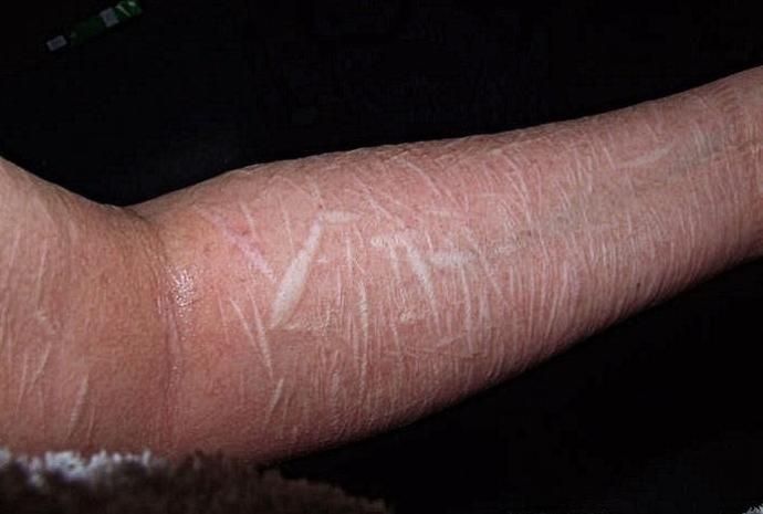 Why do people self-harm?