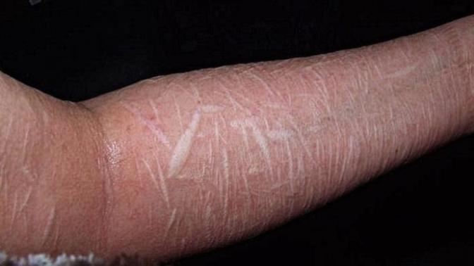 Why do people self-harm?