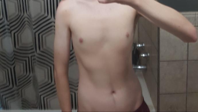 Does this look like temporary bloating or fat gain?