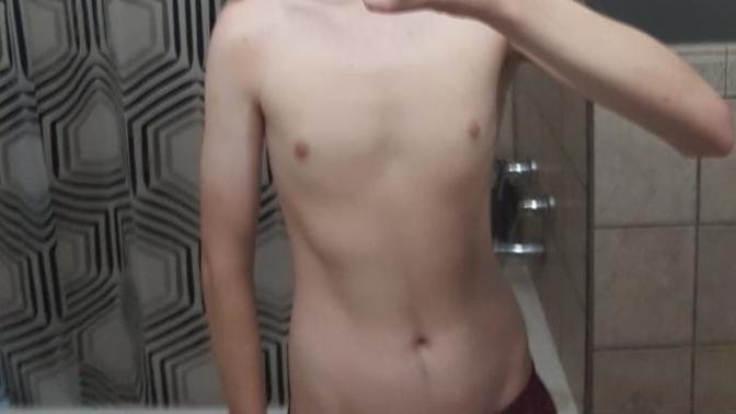 Does this look like temporary bloating or fat gain?