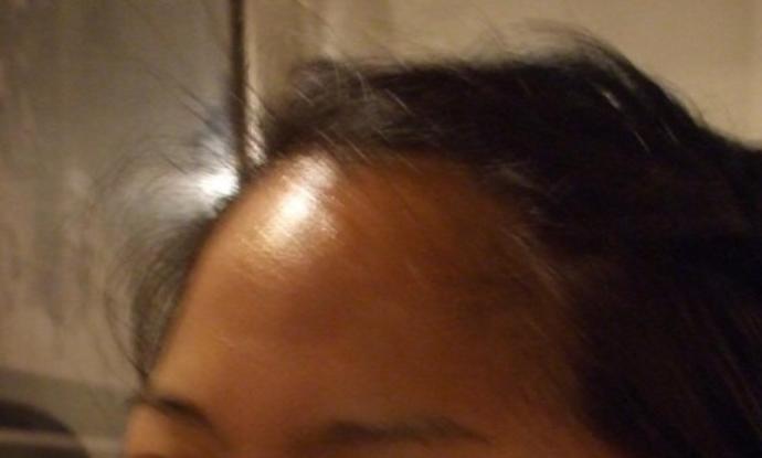 How do I get my forehead to stop being so shiny?