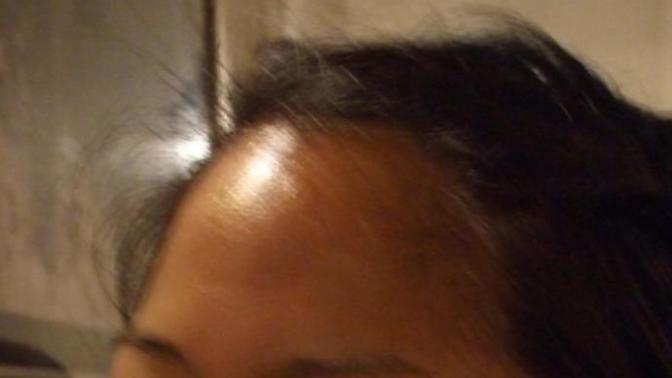 How do I get my forehead to stop being so shiny?