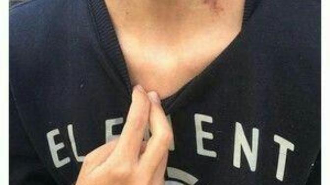 Do you enjoy giving/getting a hickey?
