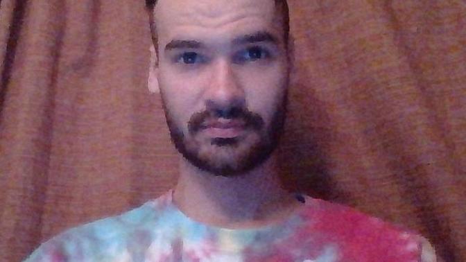 How do you think my girlfriend sees my receding hairline?