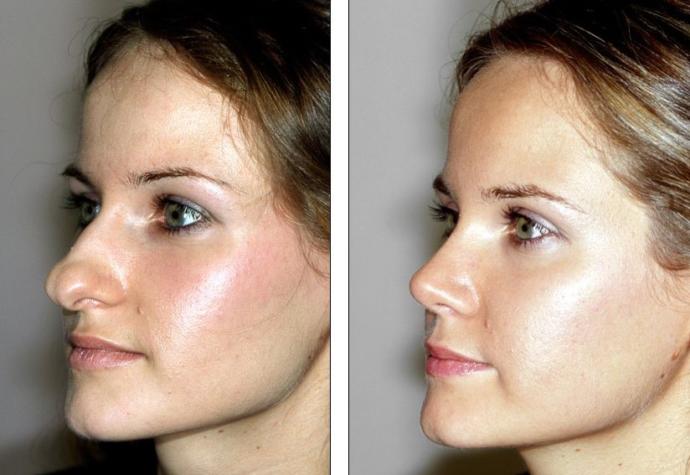 What do you think about plastic surgery?