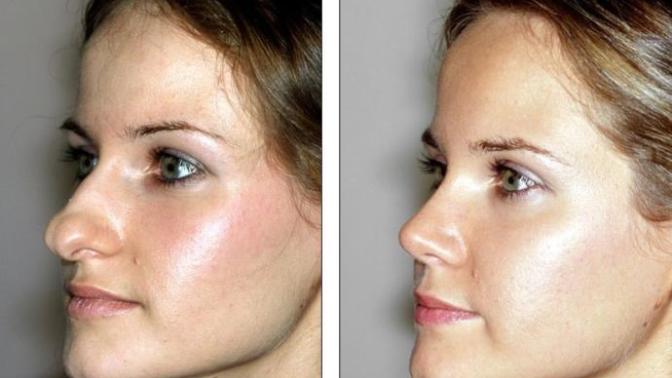 What do you think about plastic surgery?