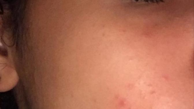 What could I do to get clear skin?