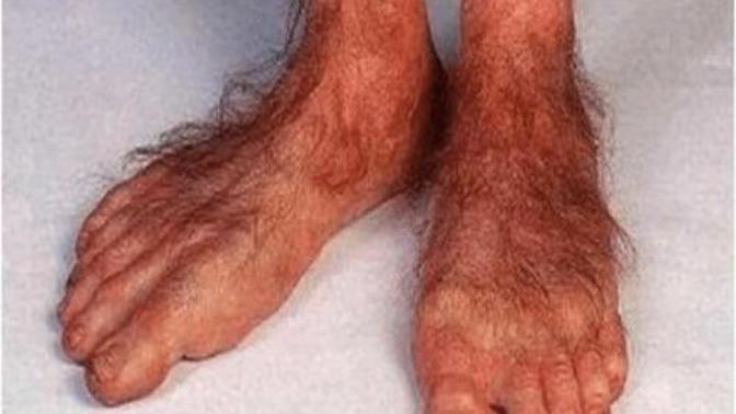 Do you shave your hobbit feet?