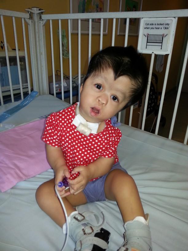 Why do families choose to keep kids who are severely deformed instead of absorption?