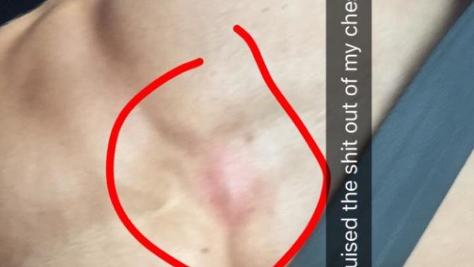 Did I hurt myself?